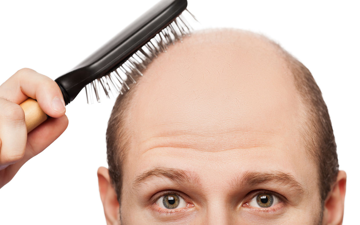 Как избавиться от густых волос у мужчин
